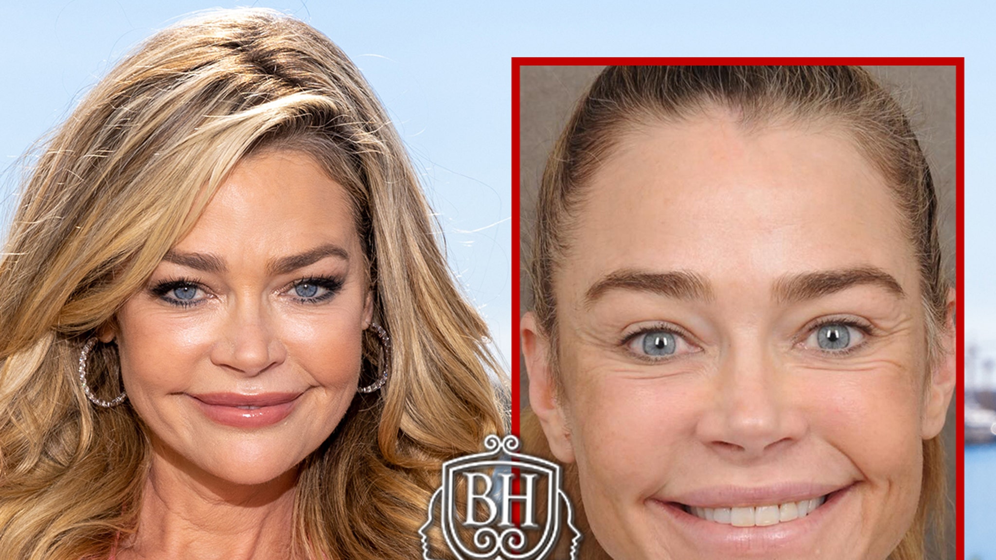 Denise Richards’ Before-and-After Pics Are Giving Her Surgeon’s Business a Lift