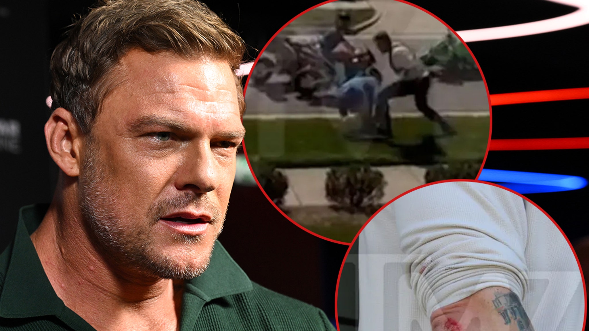 Alan Ritchson Injury Photos Taken by Cops After Street Fight With Neighbor