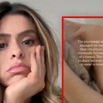 Taylor Frankie Paul Posts Bruised Arm, Opens Up About ‘Psychological Torture’
