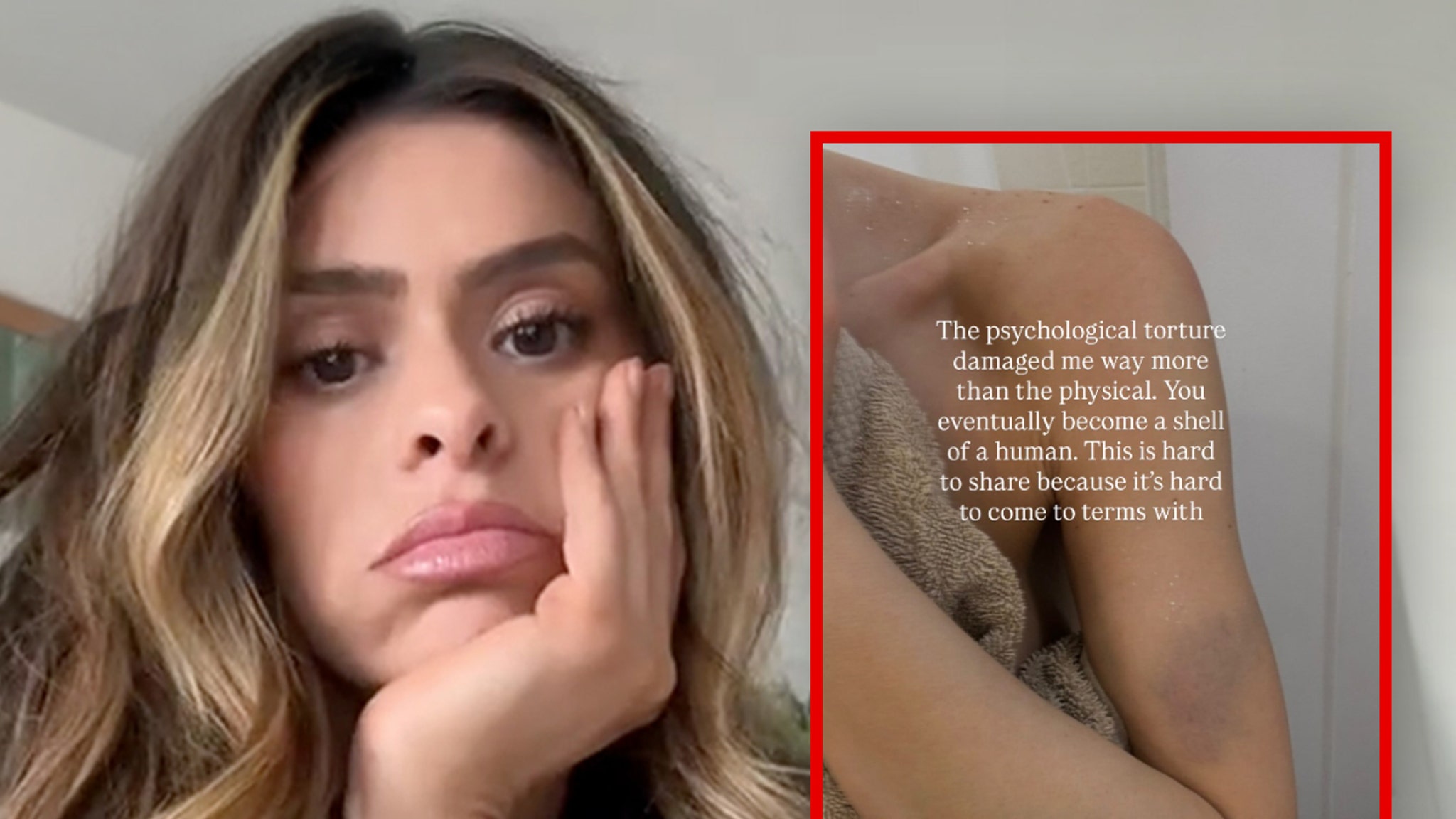 Taylor Frankie Paul Posts Bruised Arm, Opens Up About ‘Psychological Torture’