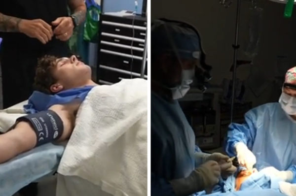 Clavicular Livestreams His Nose Job Surgery