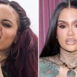 Kehlani Then And Now — Good Genes or Good Docs?!