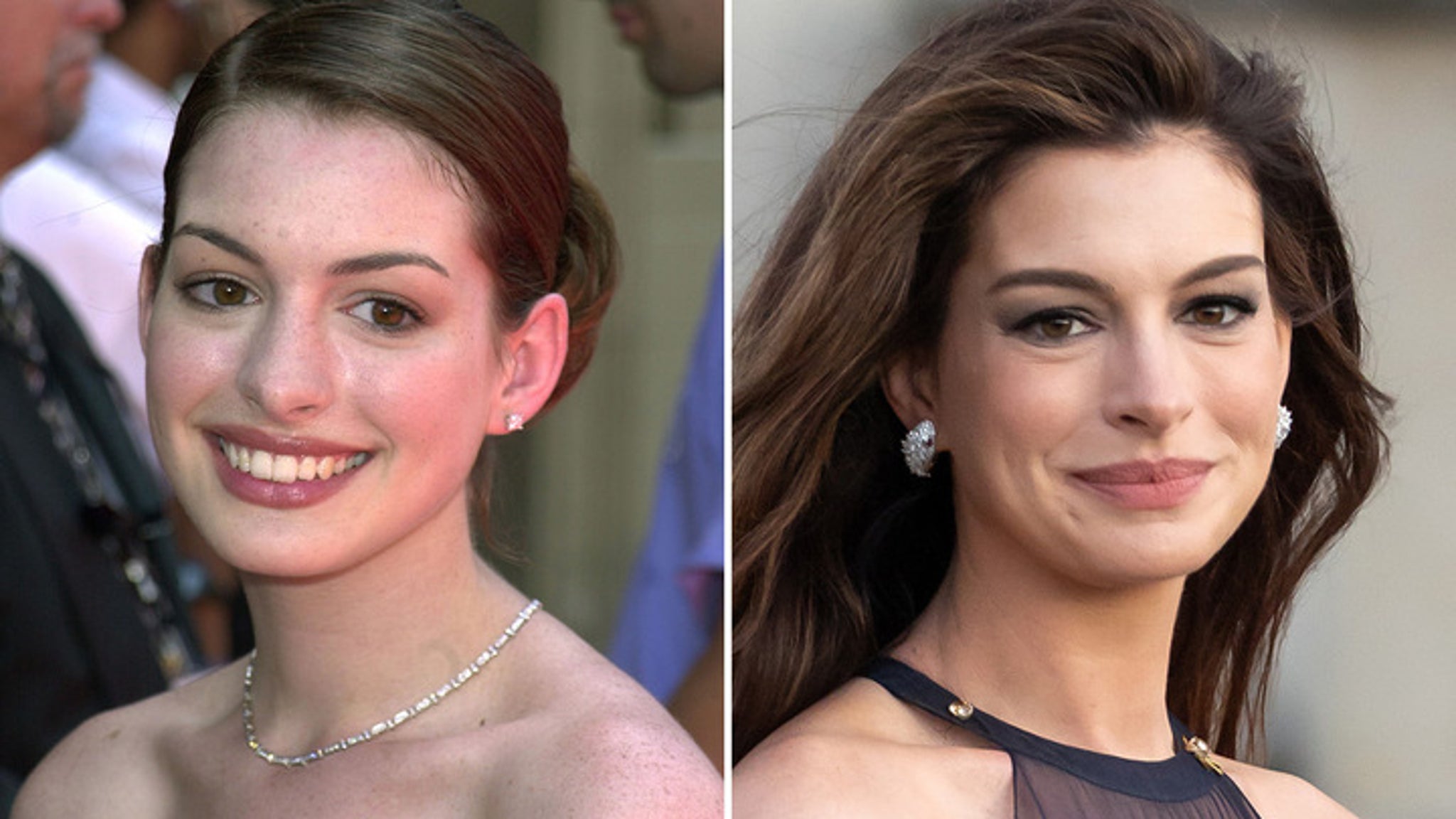 Anne Hathaway Then & Now — Good Genes or Good Docs, Hot Shots